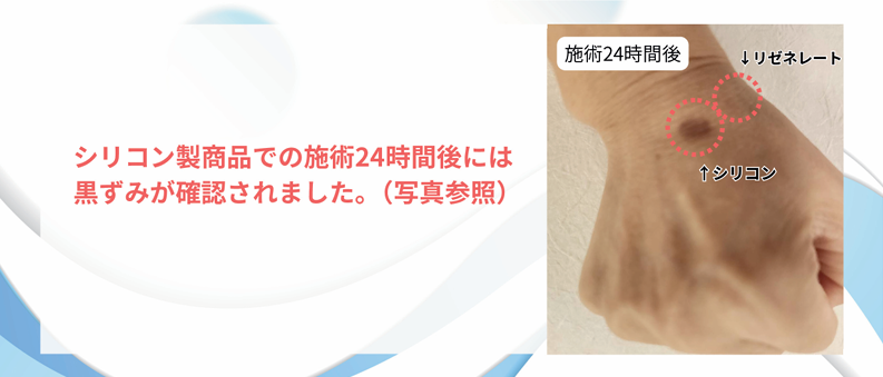 美品 リゼネレート　ダーマペン エステ版ダーマペンリゼネレート | 株式会社VILEL（LIBINVEST